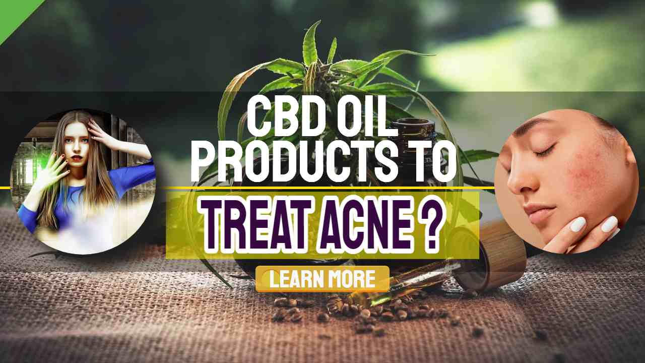 Image text: "CBD Oil Products to Treat Acne".