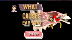 what causes earwax